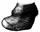 laminitis